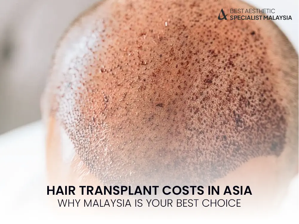 hair transplant cost asia
