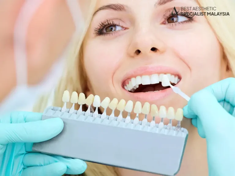 dental-whitening-procedure-malaysia-aesthetic-clinic