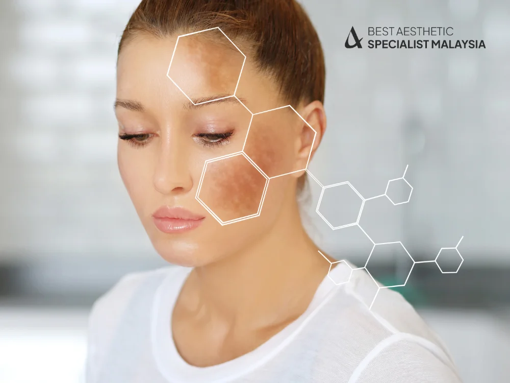 how-to-get-rid-of-dark-patches-on-face