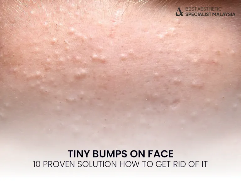 tiny-bumps-proven-solutions