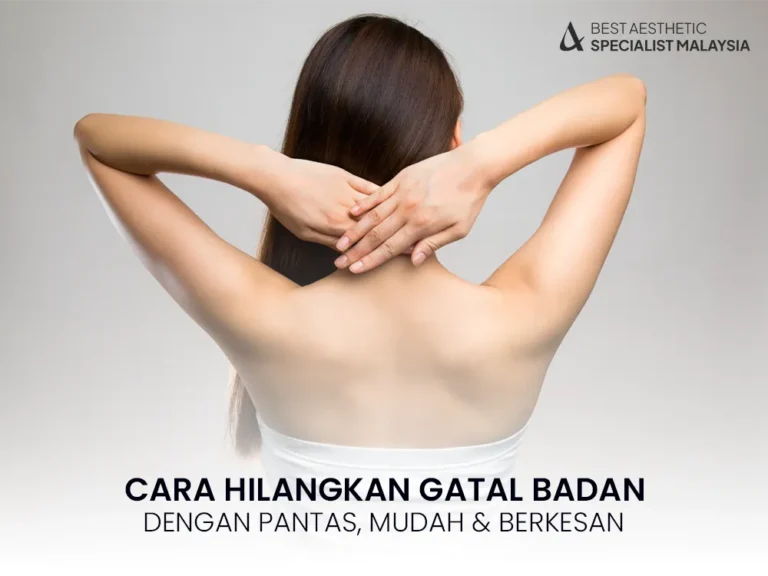 cara-hilangkan-gatal-badan-2025