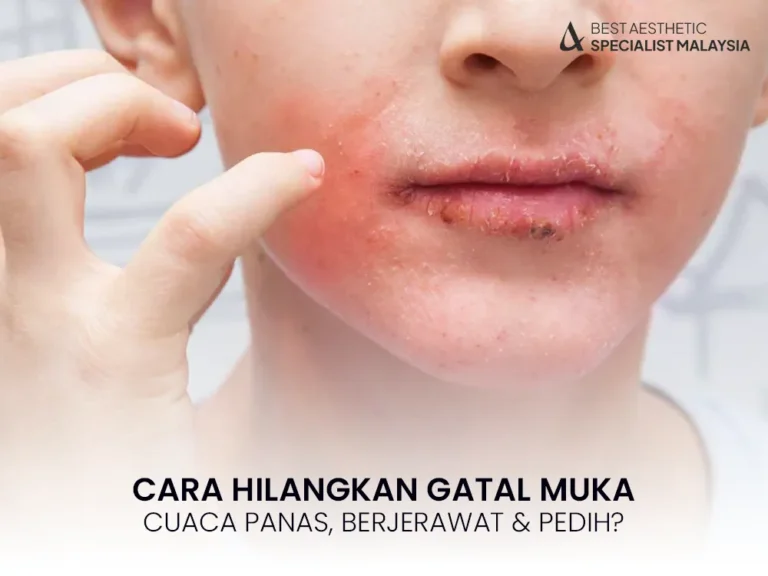 cara-hilangkan-gatal-muka-malaysia-aesthetic-clinic-1