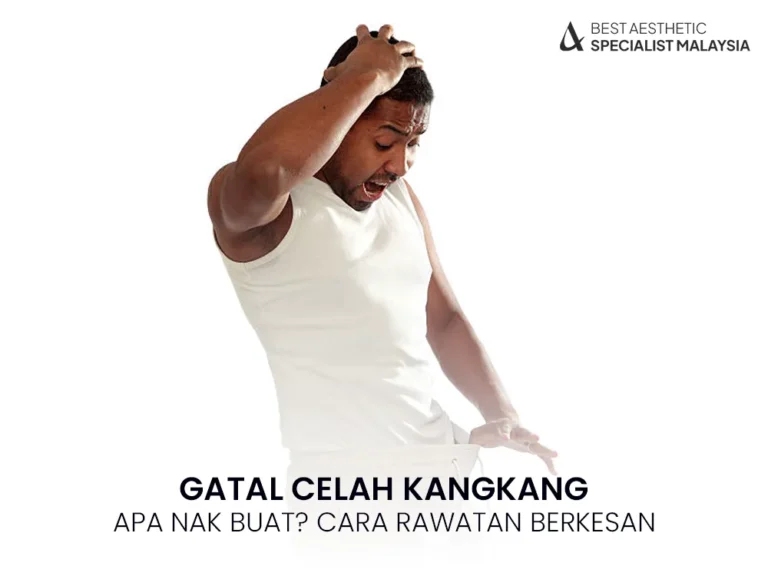 gatal-celah-kangkang-cara-rawatan-berkesan