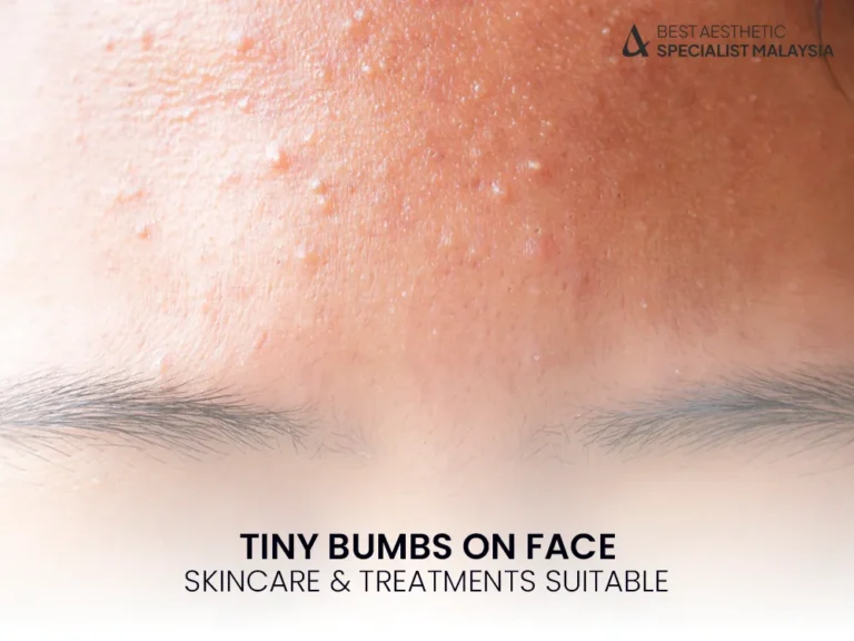 tiny-bumps-on-face-how-to-treat