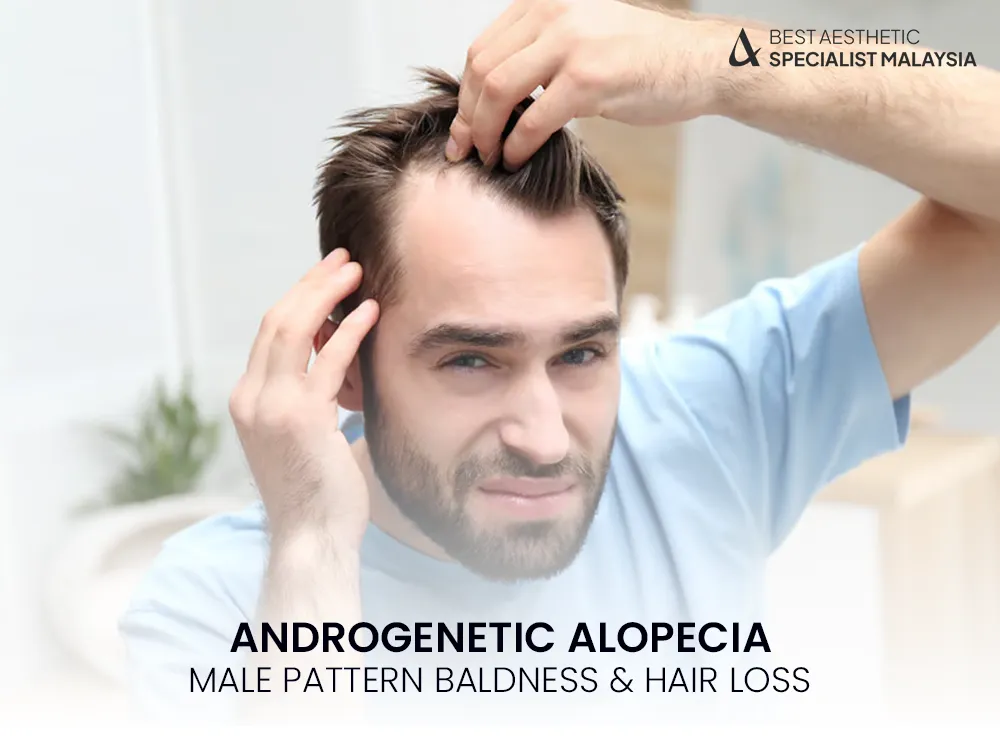 androgenetic-alopecia-men-balness