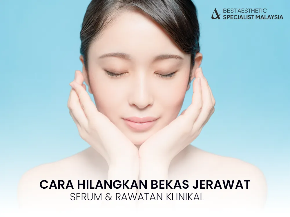 cara-hilangkan-bekas-jerawat-hitam-pipi-2025-1