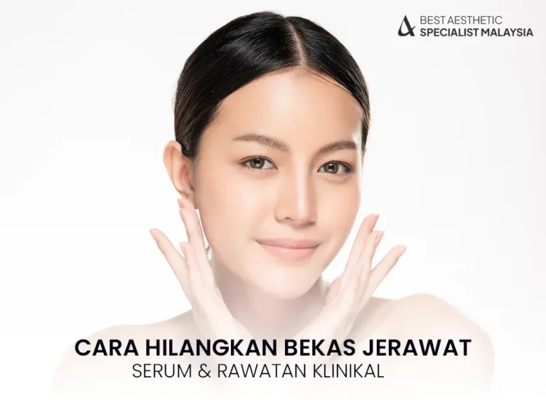 cara-hilangkan-bekas-jerawat-hitam-pipi-2025