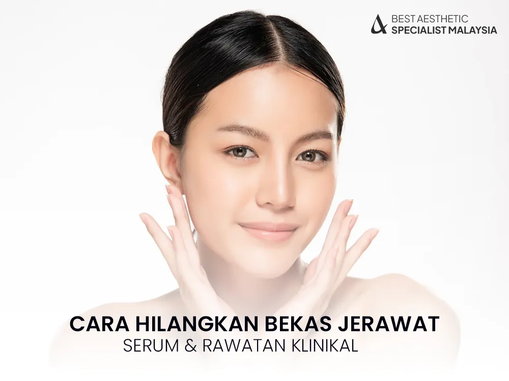 cara-hilangkan-bekas-jerawat-hitam-pipi-2025