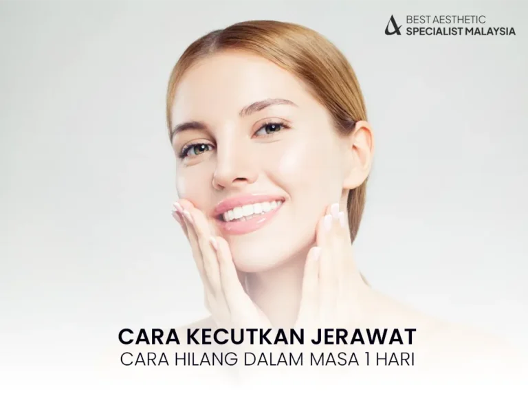 cara-kecutkan-jerawat-mudah-1-hari