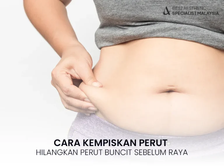 cara-kempiskan-perut-buncit-2025