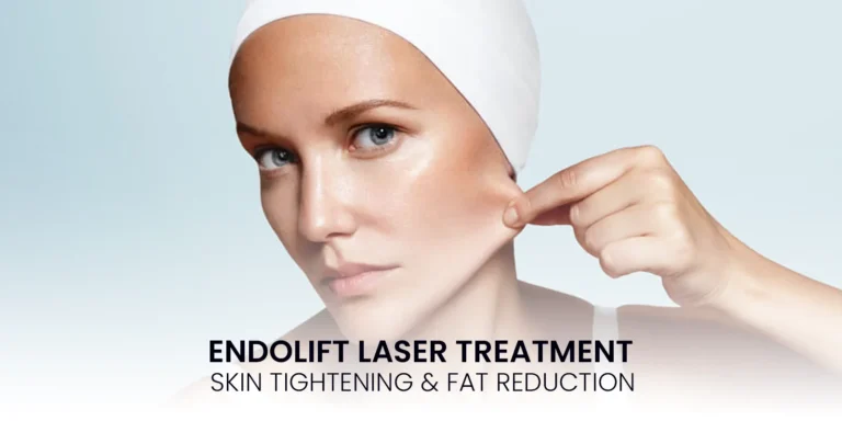 endolift-laser-treatment-skin-tightening-fat-reduction-liposuction