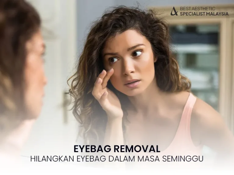 eyebag-removal-treatment-1