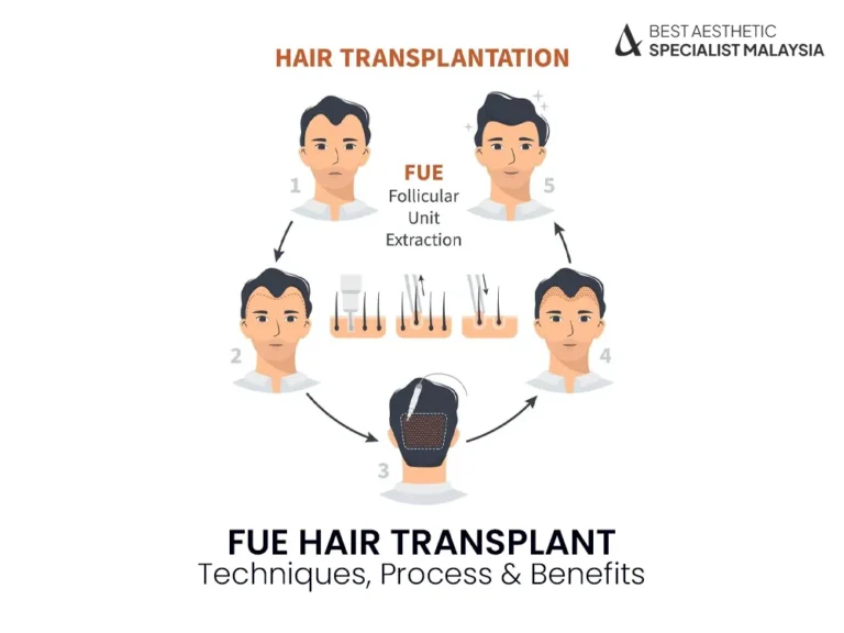 fue-hair-transplant-benefit