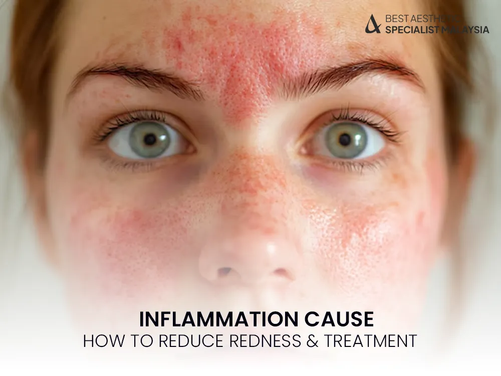 inflammation-skin-redness-causes-1