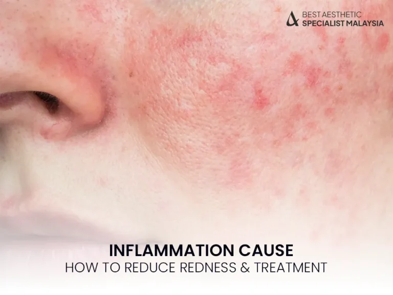 inflammation-skin-redness-causes