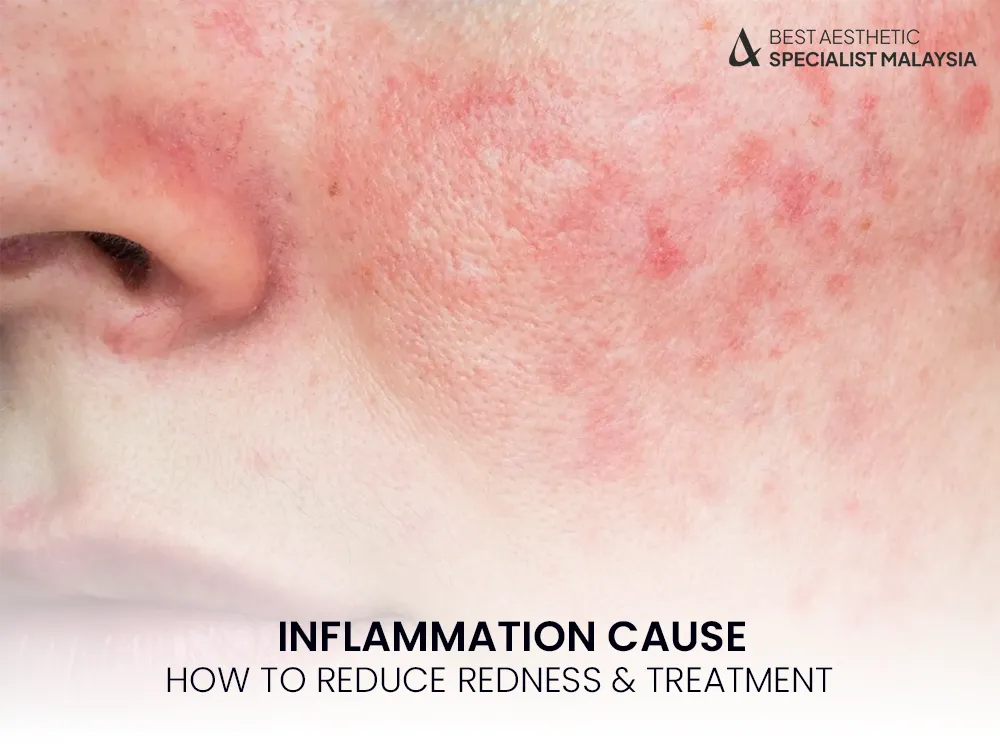 inflammation-skin-redness-causes