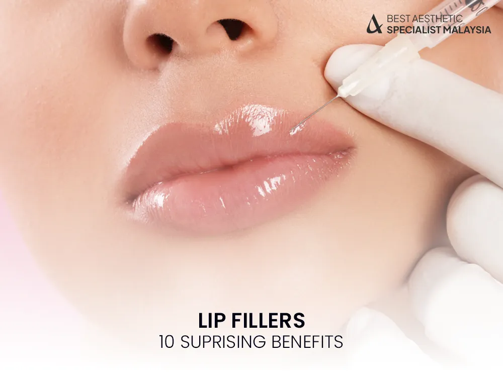 lip-fillers-malaysia