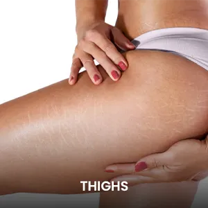 liposuction-thigh