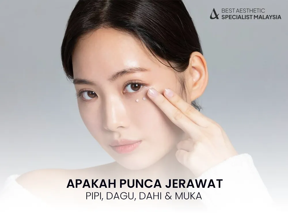 punca-jerawat-naik-penyebab-solusi-skin