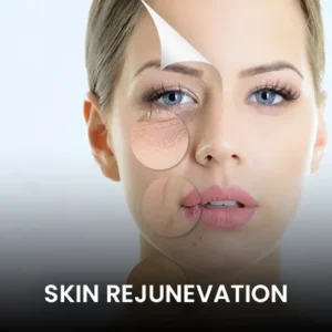 skin-rejunevation-pico-laser