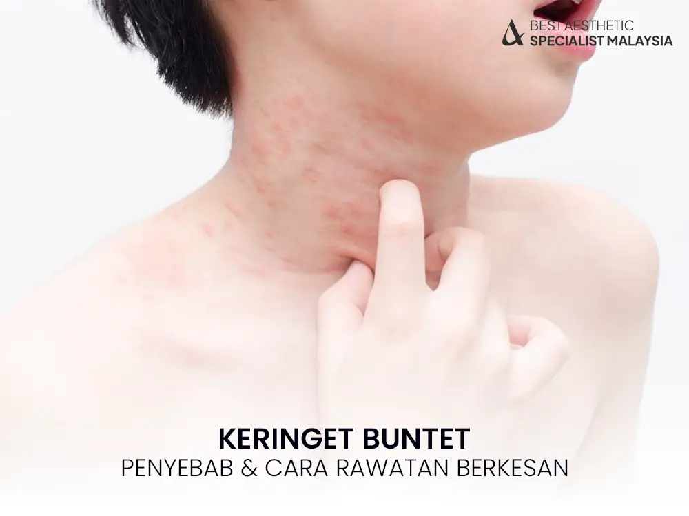 keringet-buntet-penyebab-1