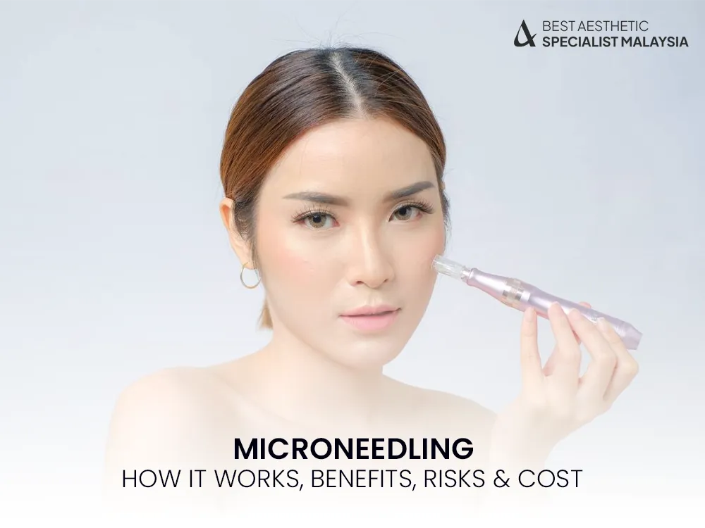 microneedling