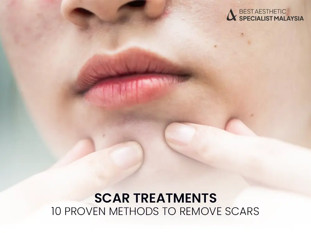 scar-treatments-proven-method