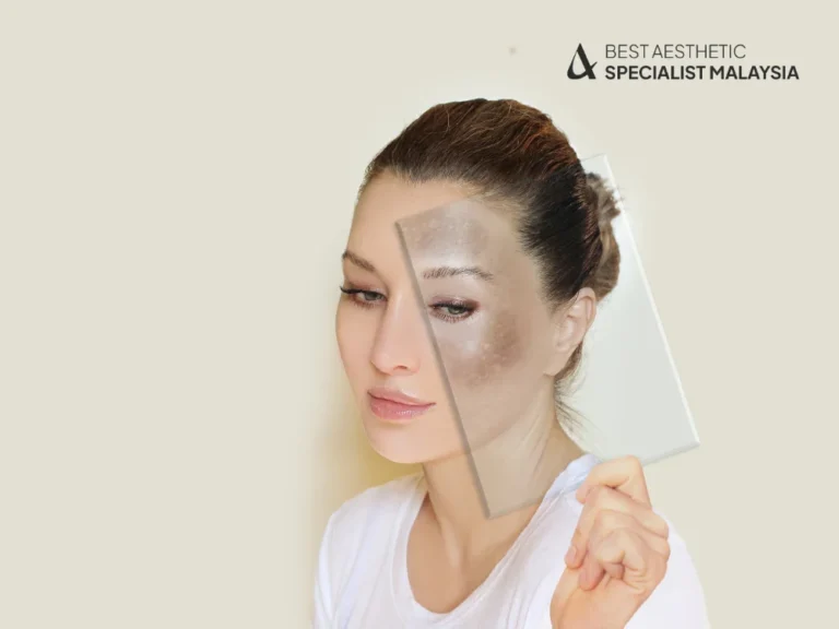 skin-hyperpigmentation