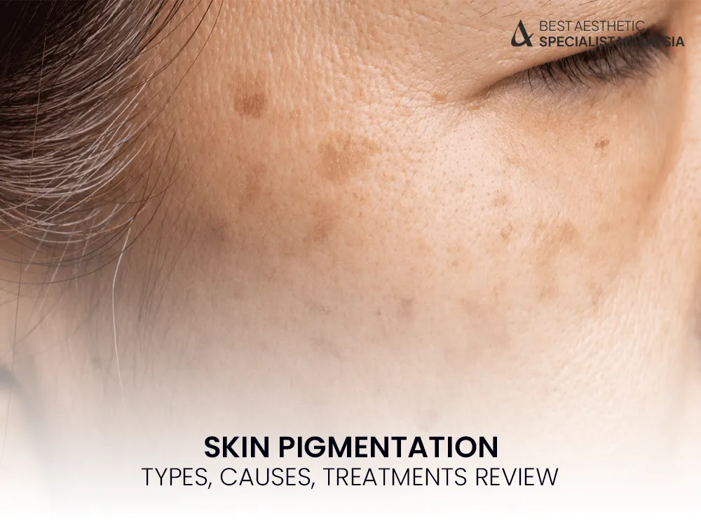skin-pigmentation-hyperpigmentation-review-1