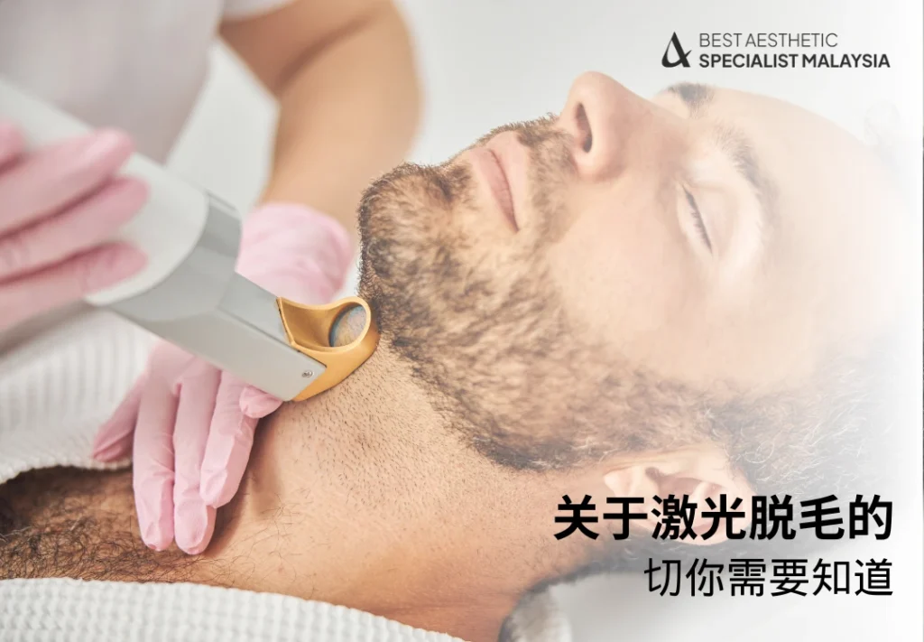 激光脱毛