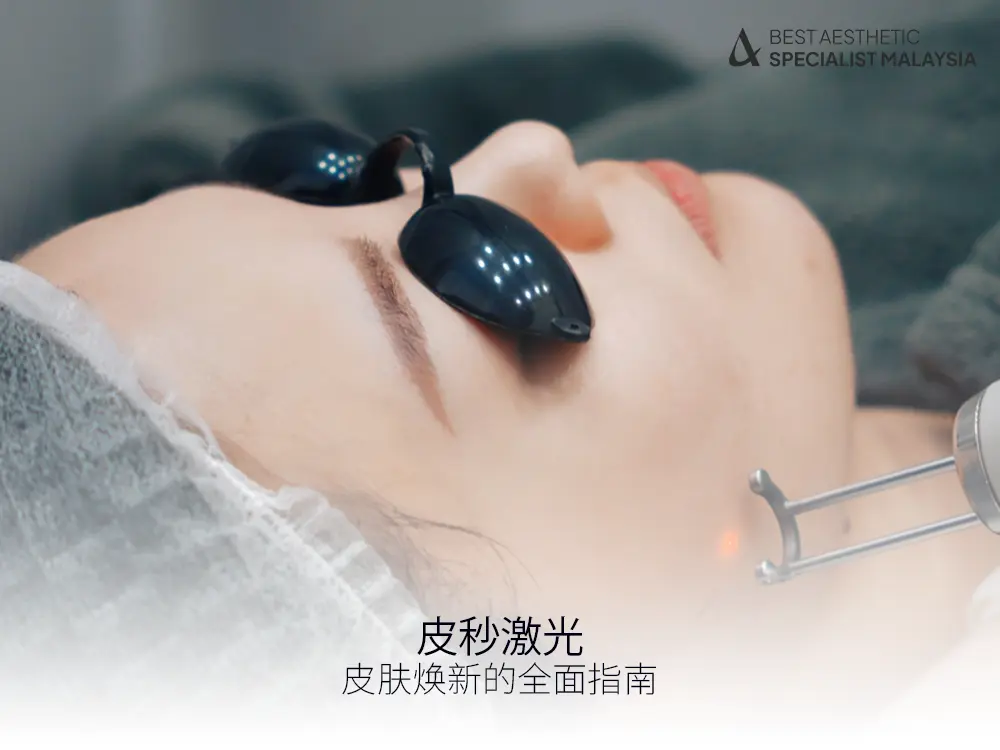 皮秒激光