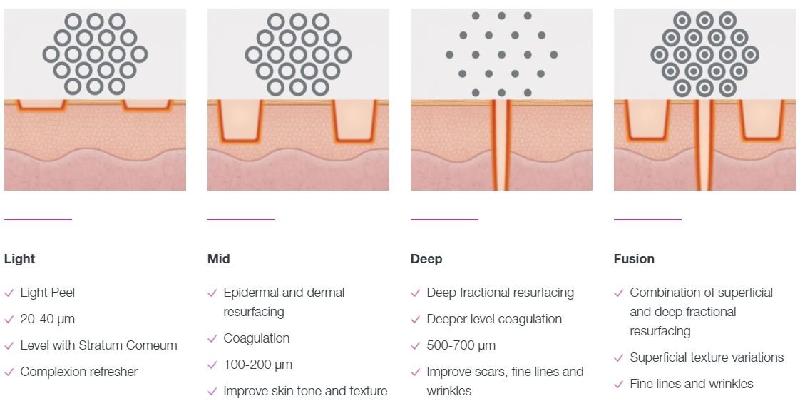 fractional-co2-laser-malaysia