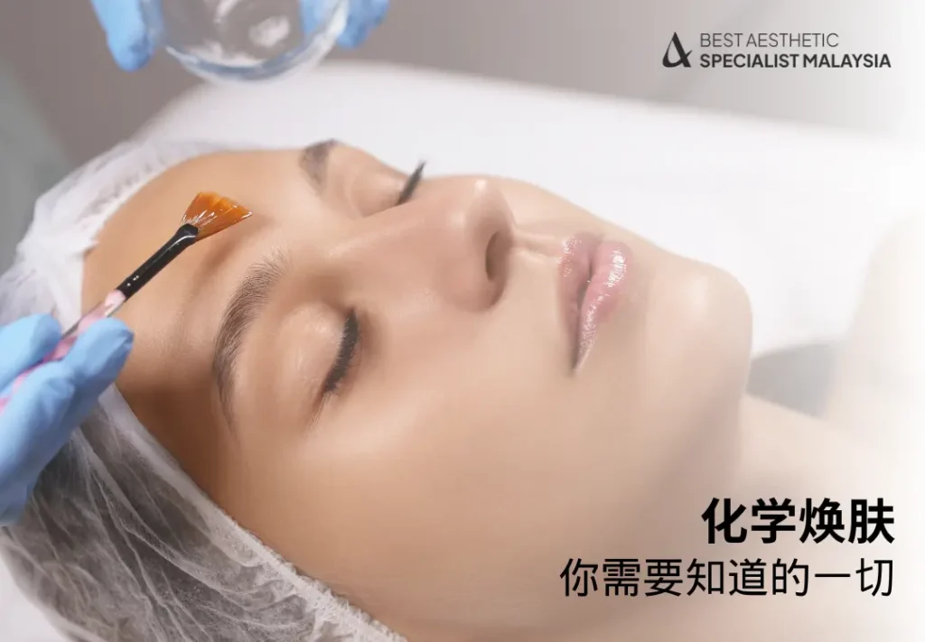 化学焕肤