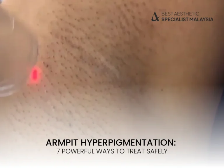 armpit-hyperpigmentation