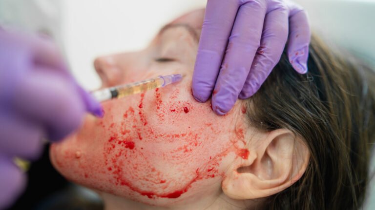 prp-face-treatment-malaysia-kuala-lumpur
