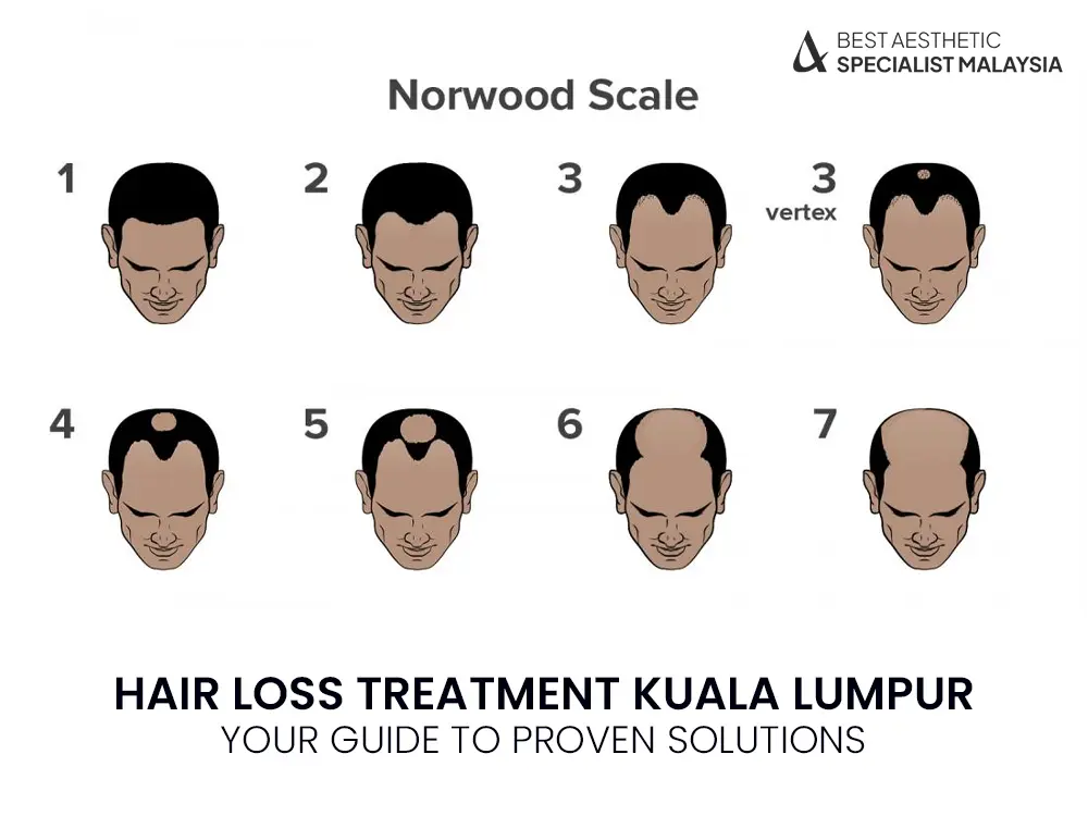 hair-loss-treatment-kuala-lumpur-norwood-scale