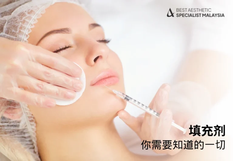 填充剂