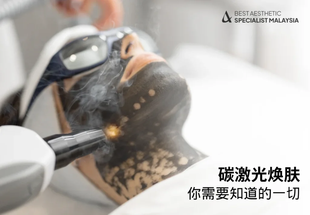 碳激光焕肤