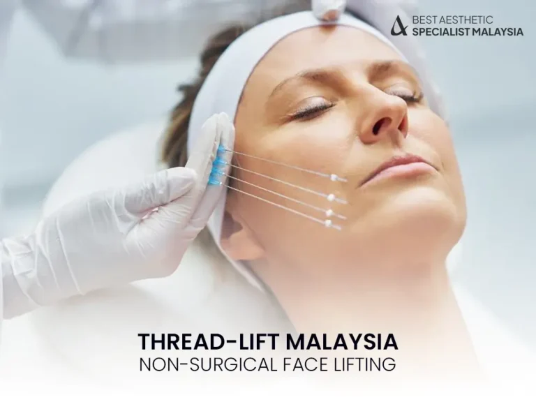 THREAD-LIFT