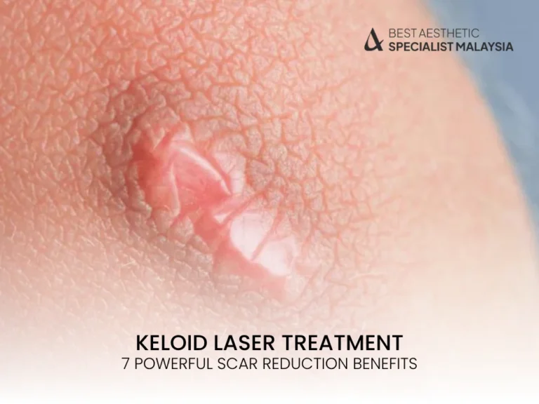 keloid-laser-kl