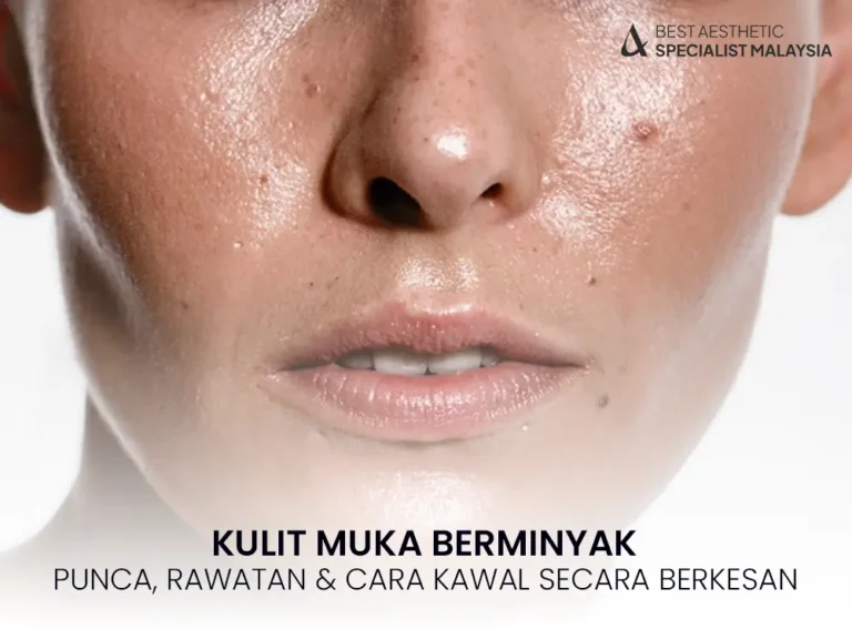 kulit-muka-berminyak-punca-rawatan