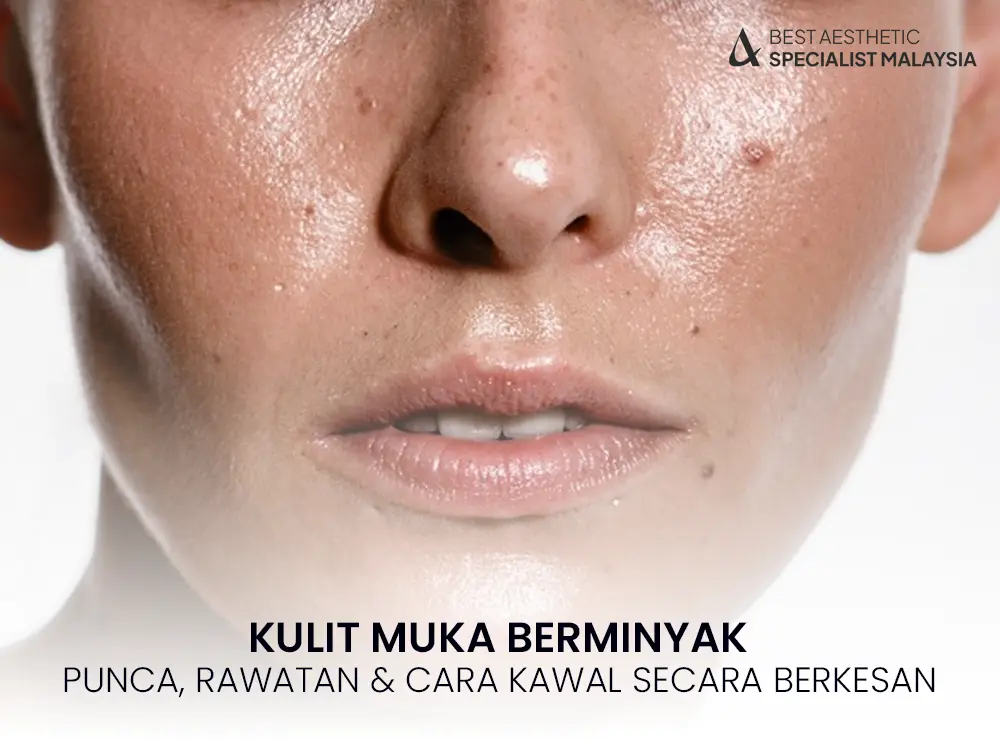 kulit-muka-berminyak-punca-rawatan