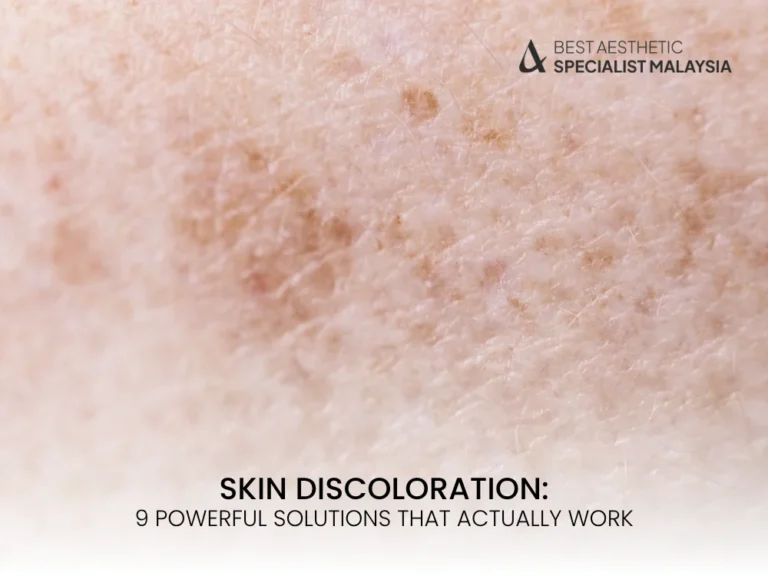 skin-discoloration
