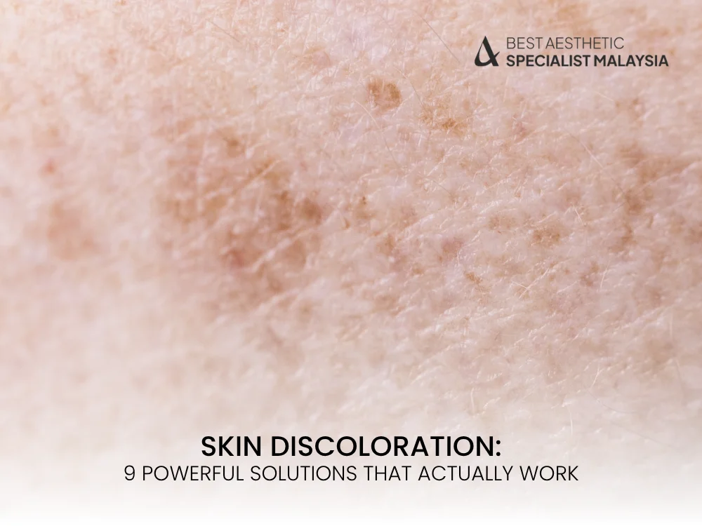 skin-discoloration