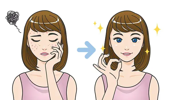 skin-hyperpigmentation-treatment