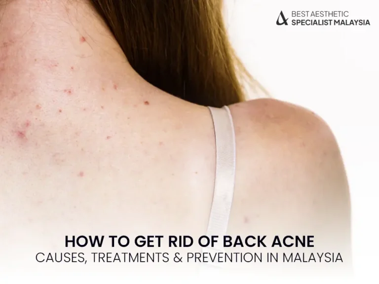 back-acne-malaysia-treatment