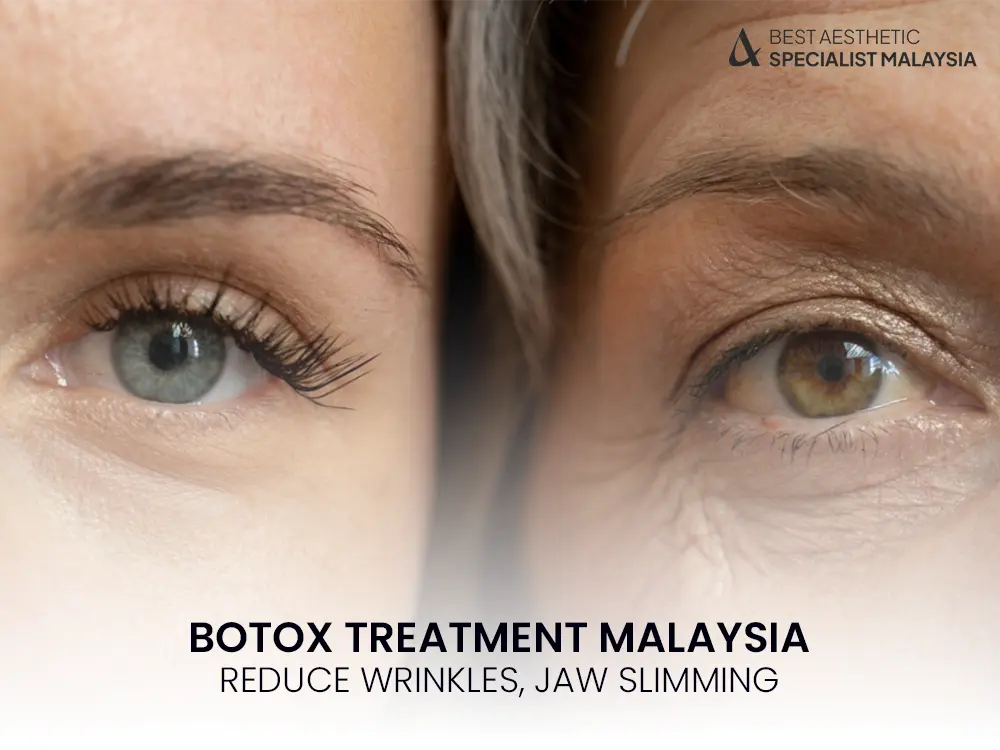 Botox Treatment Malaysia: Reduce Wrinkles, Jaw Slimming & Non-Surgical Facial Rejuvenation 10 botox-injections-treatment-malaysia