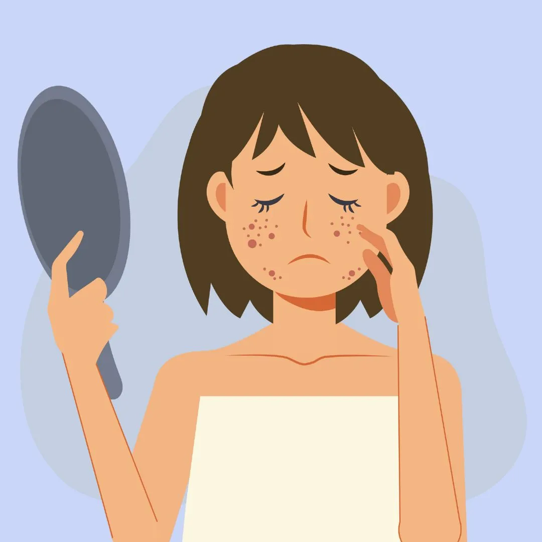 remove-dark-patches-on-face