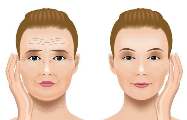 tiny-bumps-on-forehead
