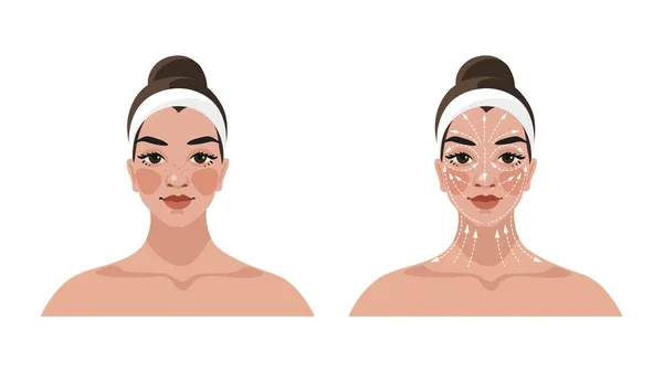 v-shape-face-treatment